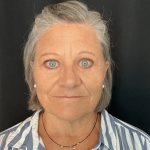 Brow Lift Before & After Patient #1567